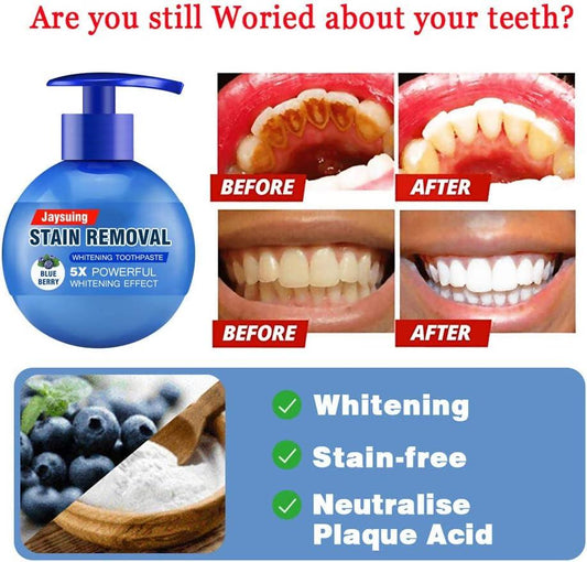 ORIGINAL stain removal whitening